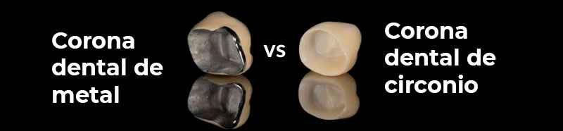 Comparación entre corona dental de metal y corona dental de zirconio